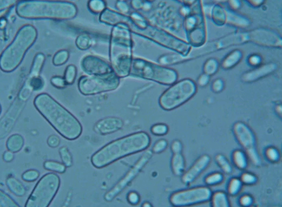 Newly identified bacterial protein
